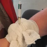 Bandaging an arm around an impaled object to demonstrate safe first aid immobilisation technique.